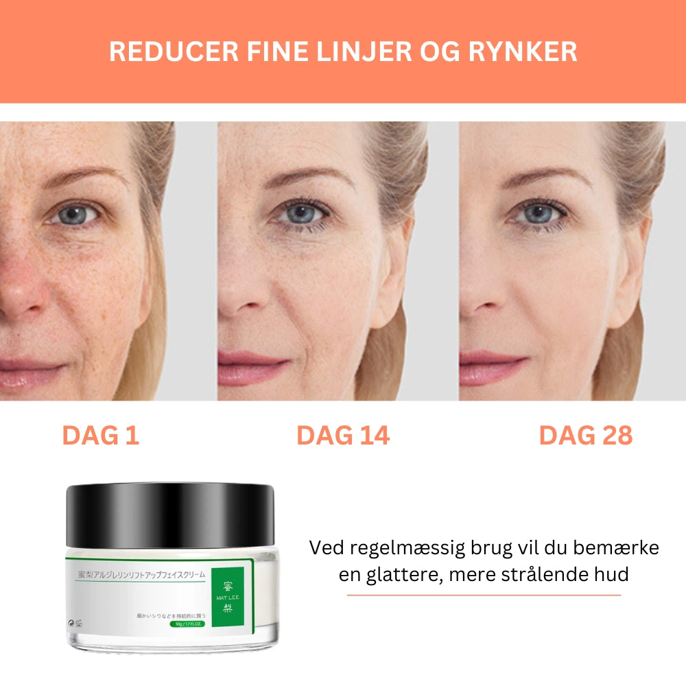 RadiantLift® | Naturlig Anti-Aging Løsning til Følsom Hud!'