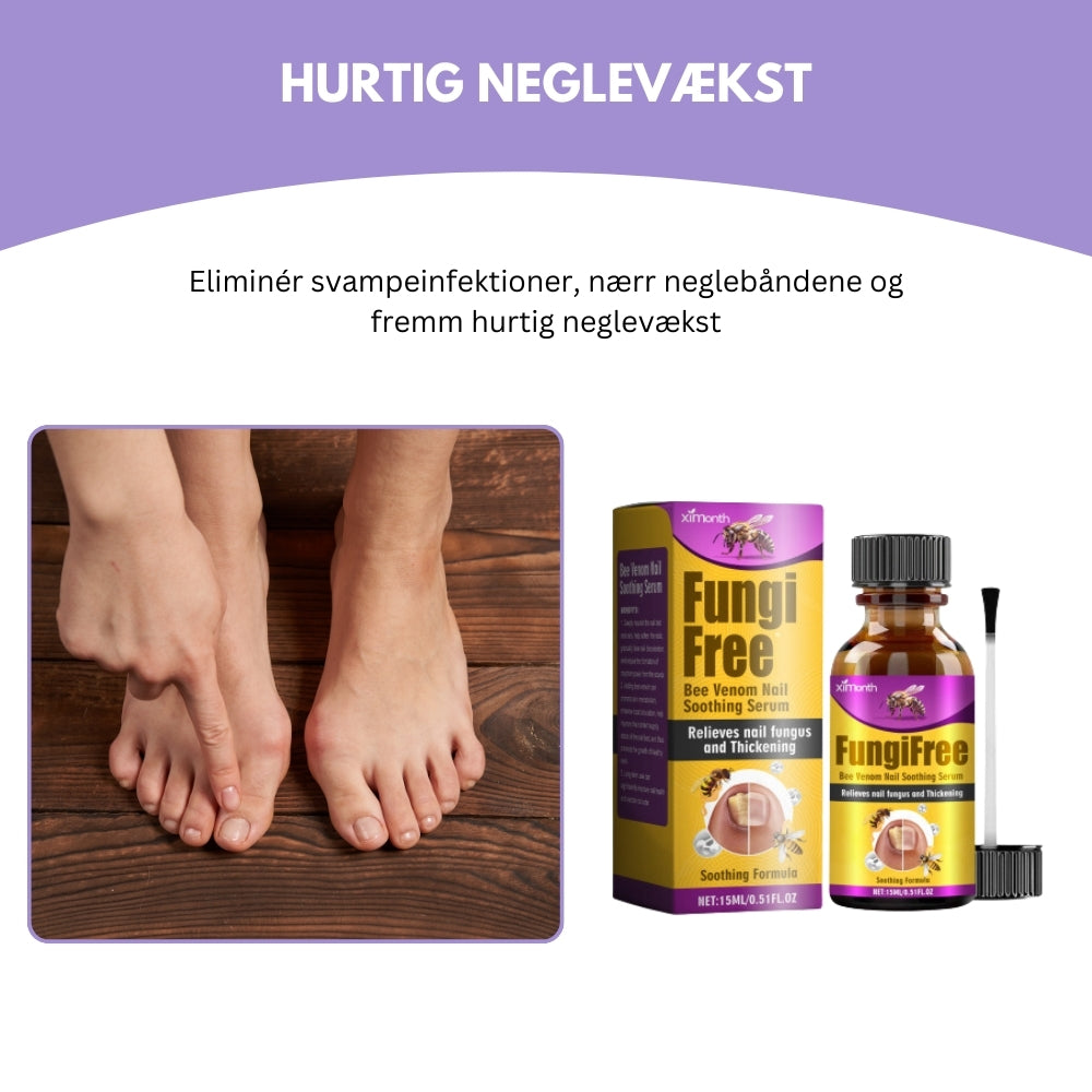 AntiFungix® | Sig Farvel til Neglesvamp og Hej til Sunde Negle!