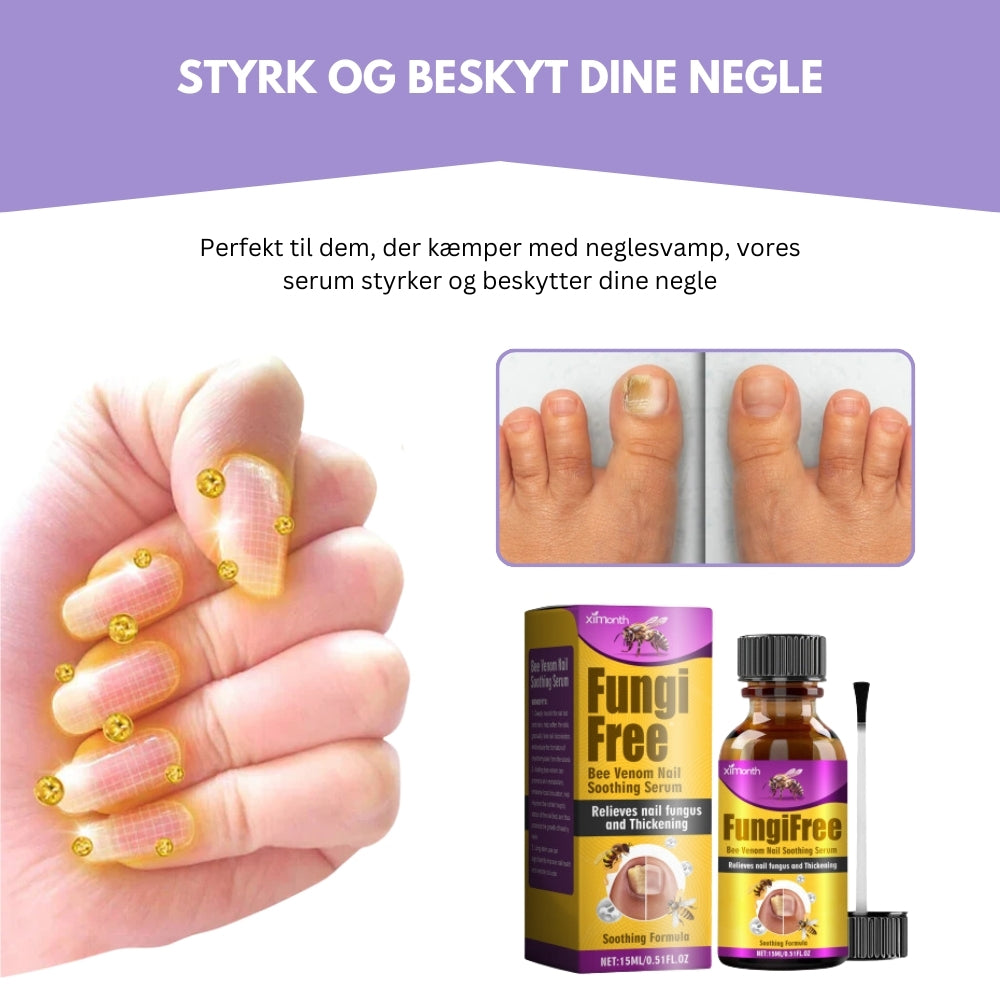 AntiFungix® | Sig Farvel til Neglesvamp og Hej til Sunde Negle!