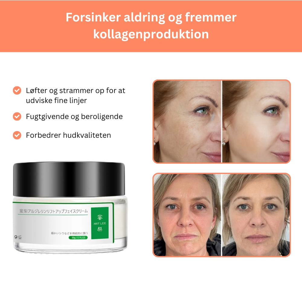 RadiantLift® | Naturlig Anti-Aging Løsning til Følsom Hud!'